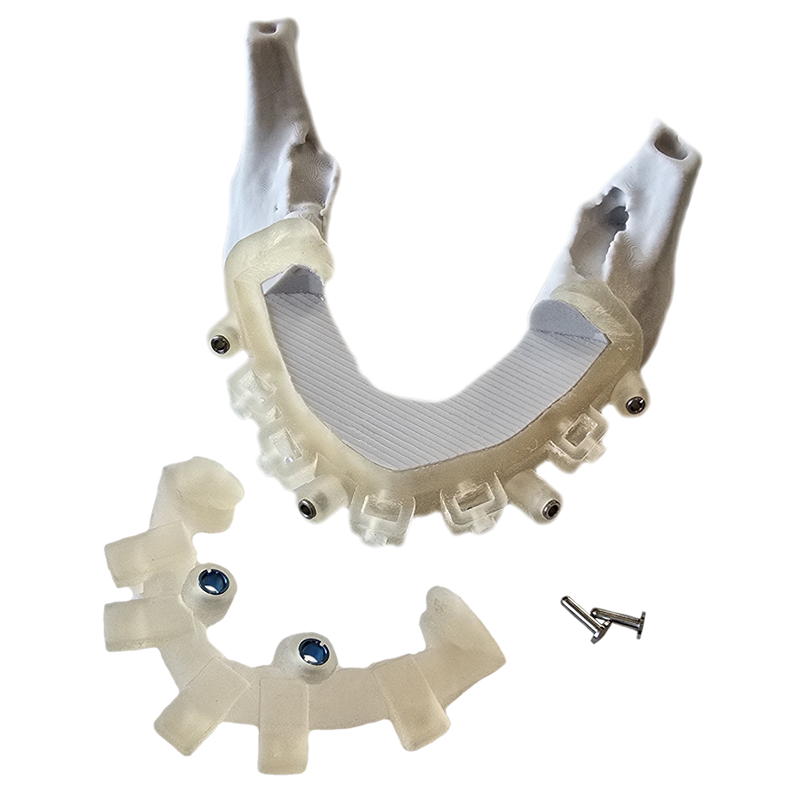 Stackable surgical guide
