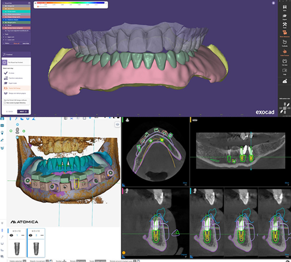 ct scan