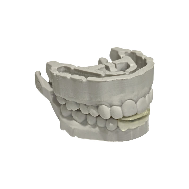 NTI device