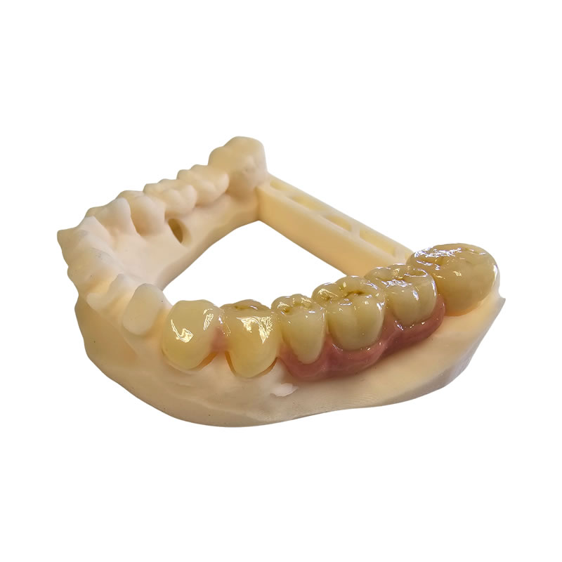 layered zirconia