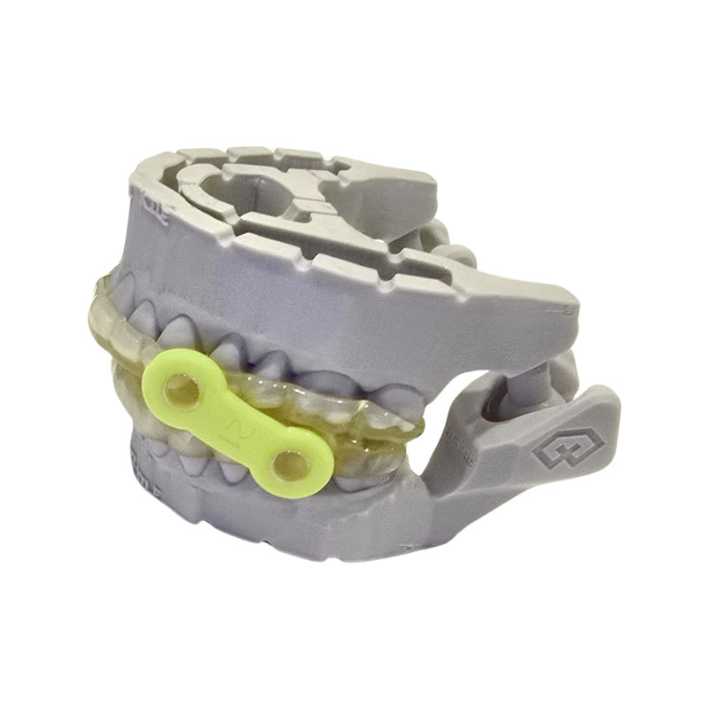 sleep apnea appliance