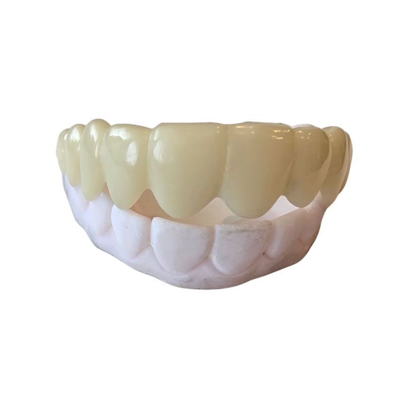 snap on smile