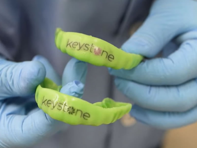sports mouthgusrd keystone